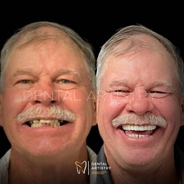 Slider image (8) Dental Artistry Dental Center